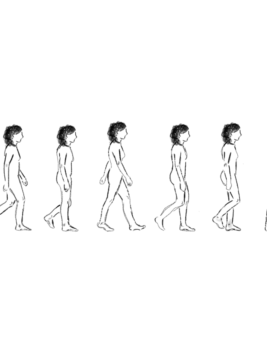 Variabilidad de la marcha y riesgo de caídas en personas con esclerosis múltiple